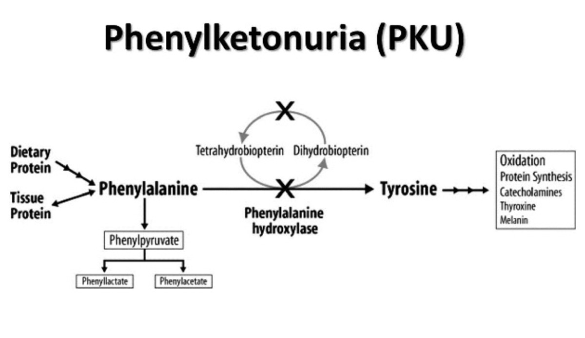 Decreasing in Lysine Reflect Lysosomal Dysfunction and Accumulated Phenylalaninewhich Connected to WMH and CVD and Both of Phenylketonuria and Calcificationswhere N-Acetylcysteine Prevent Organs Failure