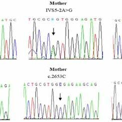 A Novel Heterozygous Splice Donor Variant in TRIM28 Gene Causing Beckwith-Wiedemann Spectrum: Case Report and Literature Review