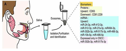 Role of Salivary Biomarkers for Early Oral Cancer Detection: A Review